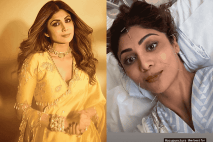 Shilpa Shetty Creates Buzz With her Acupuncture Treatment Post On Instagram